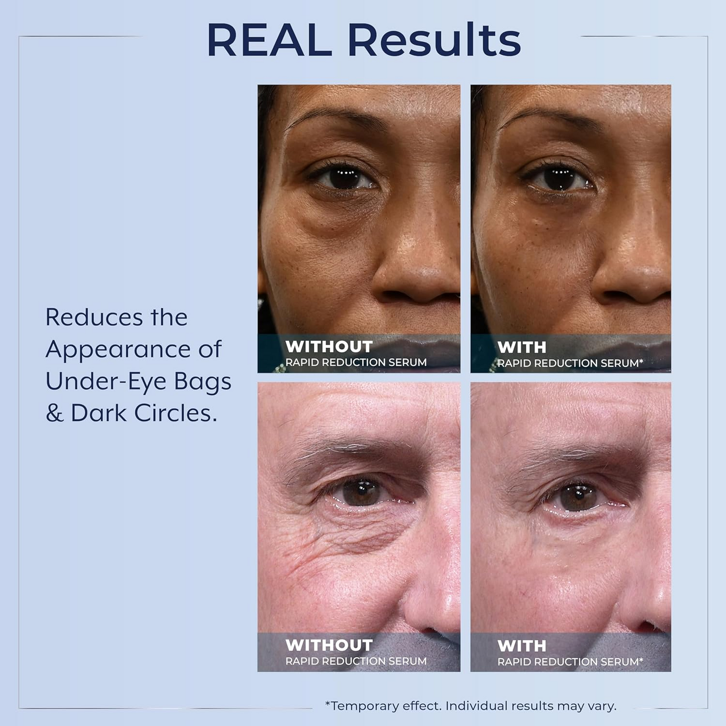 Plexaderm Rapid Reduction Eye Serum - Visibly Reduces Under