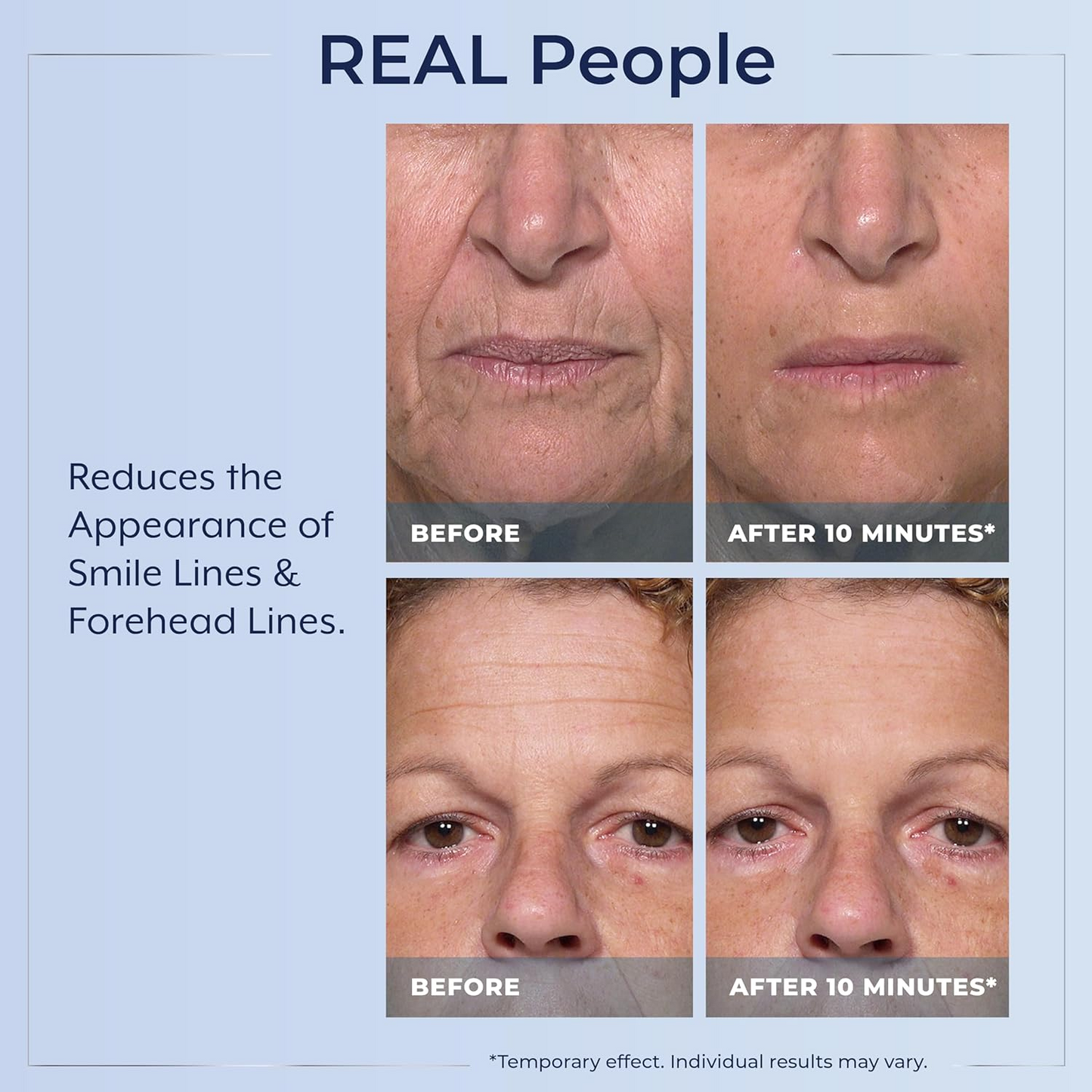 Plexaderm Rapid Reduction Eye Serum - Visibly Reduces Under