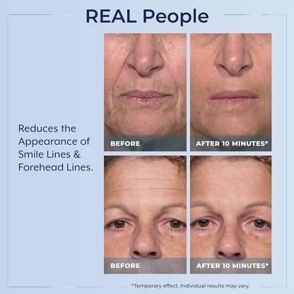 Plexaderm Rapid Reduction Eye Serum - Visibly Reduces Under