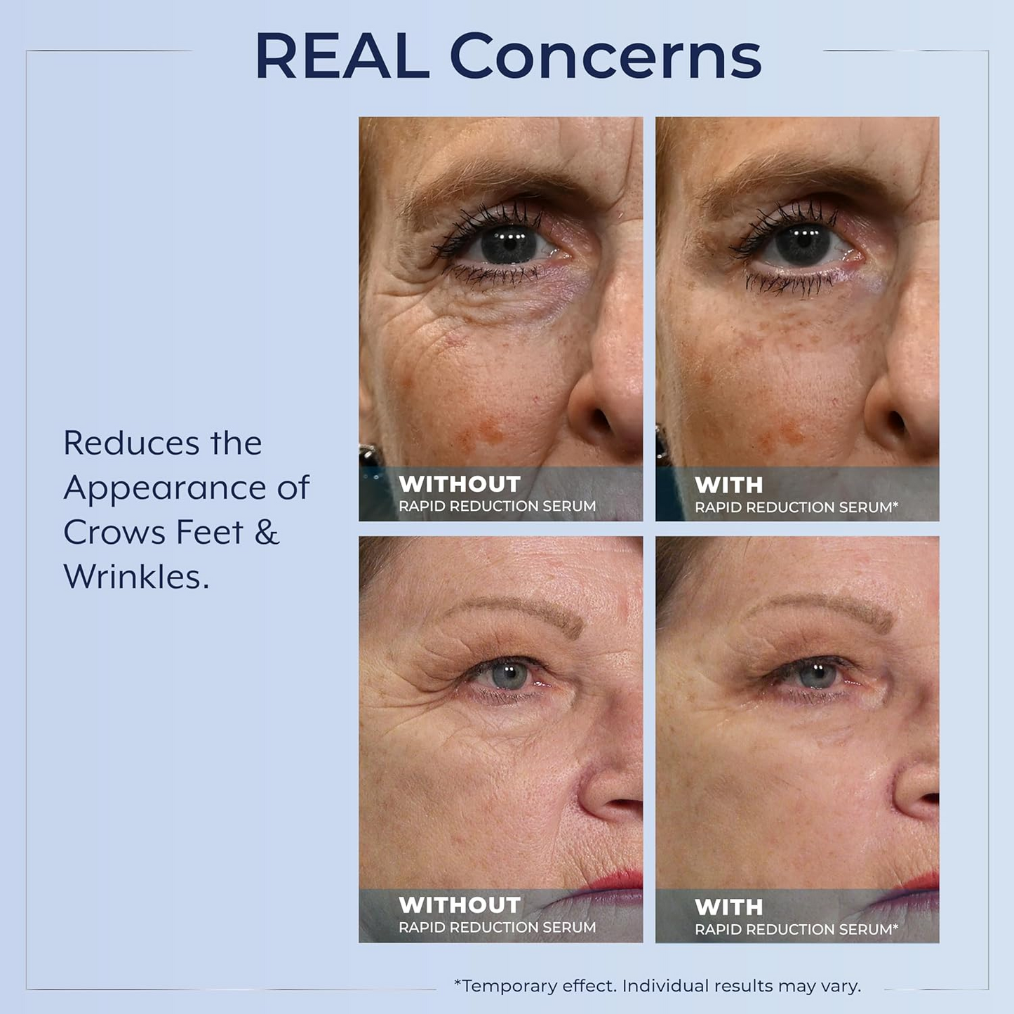 Plexaderm Rapid Reduction Eye Serum - Visibly Reduces Under
